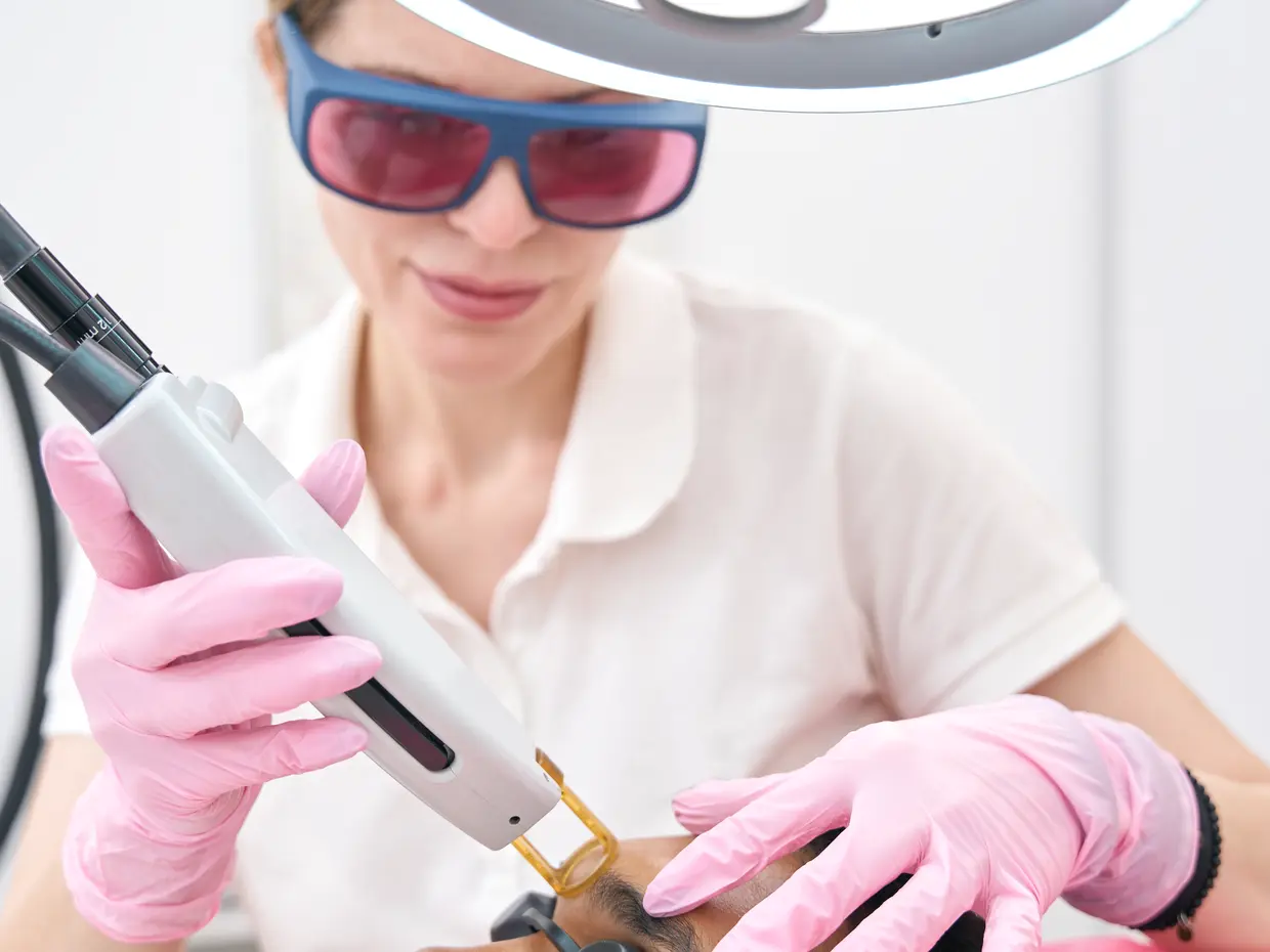 cosmetic laser treatment on adult male face
