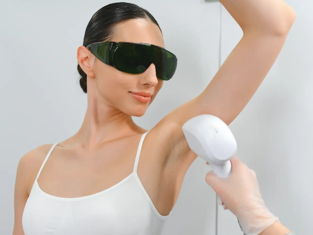 woman receiving laser hair removal on underarm