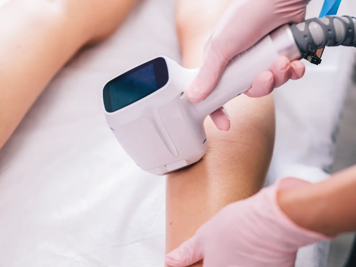 laser hair removal on a person's leg