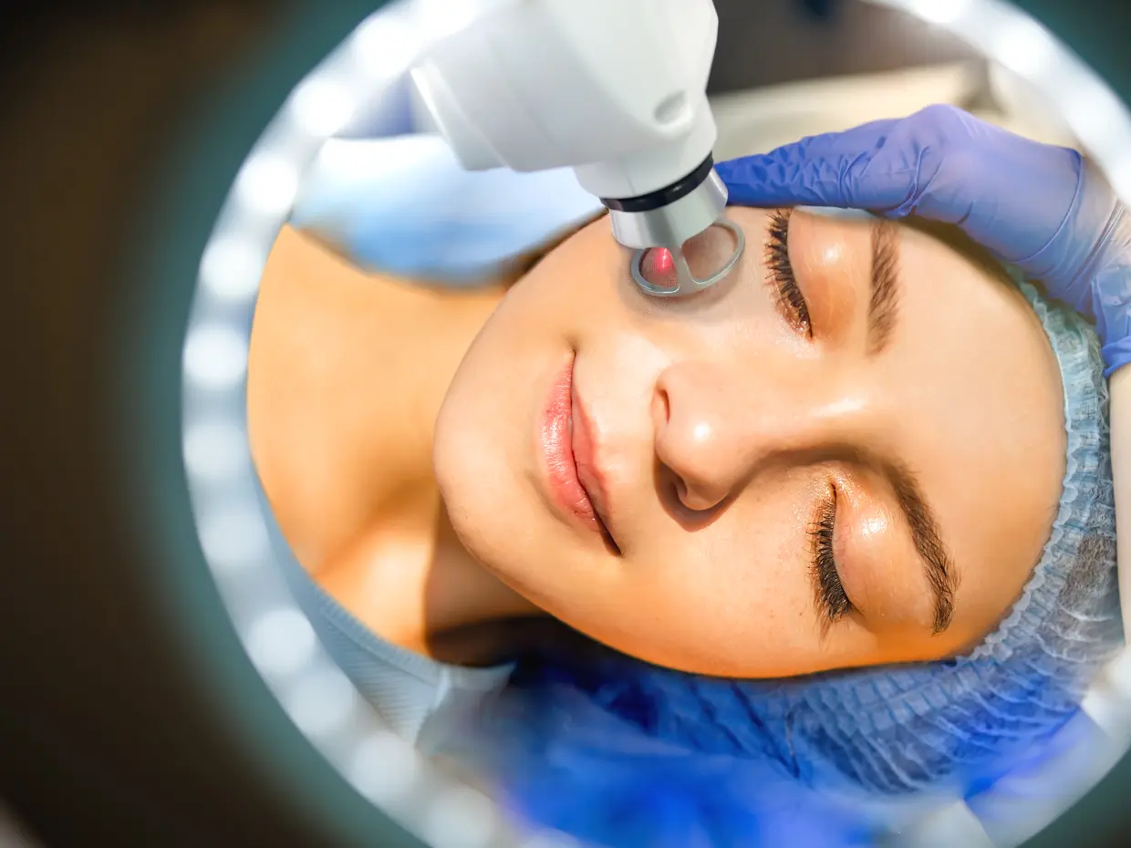 woman receiving laser treatment on face