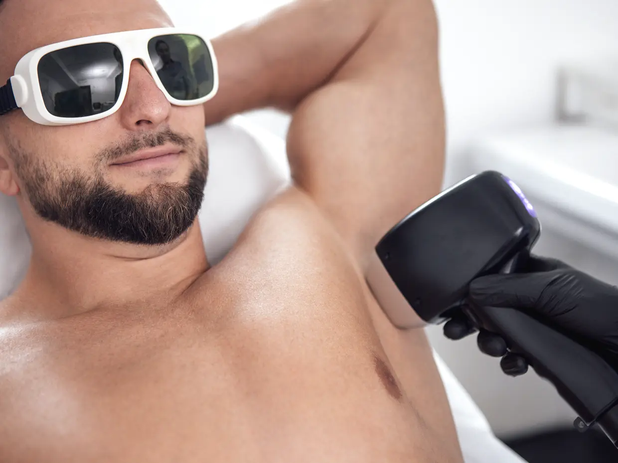 man receiving laser hair removal on underarm