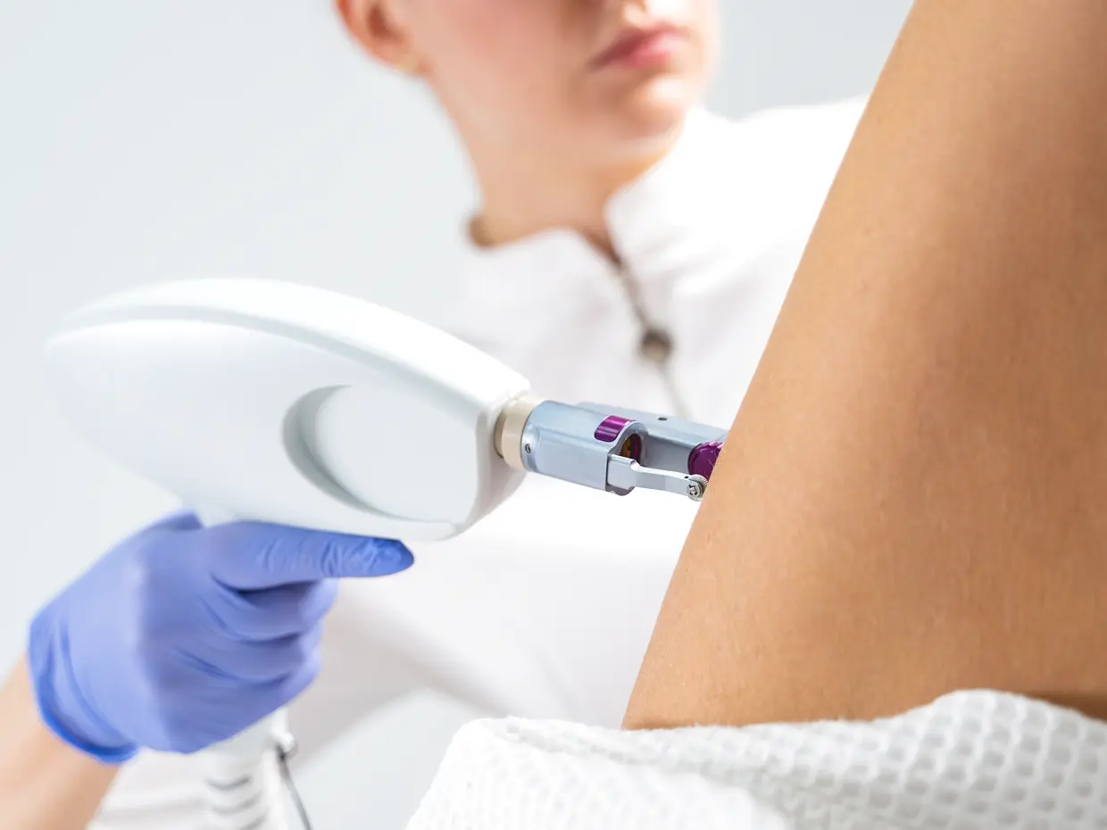 laser hair removal treatment on leg